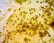 Nosema microscope