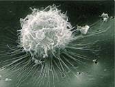 PRRS Macrophage healthy