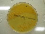 E coli tergitol 2