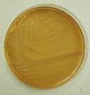 Bordetella bronchiseptica mac