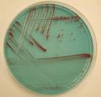 Bordetella bronch tergit