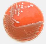 Pasateurella multocida A blood