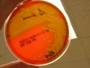 Strep suis blood a haem