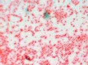 Actinobacillus suis 1