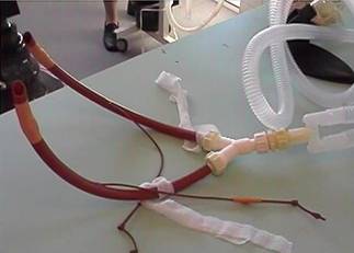 Surgery endotracheal tubes 2
