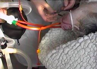 Surgery op anaethesia