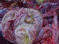 Gastric ulcer ca