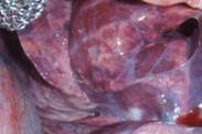colitis necrotic terminal au 2 lung
