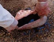 Gastric ucler haemorrhage au