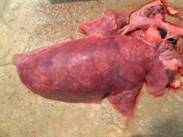 Pulmonary oedema 2001a