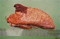 Pneumonia inhalation weaner