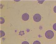 Eperythrozoonosis blood smear