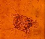 Mange mite microscope