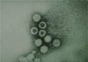 Virus particles 2
