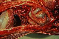 ASF Abdomen 1