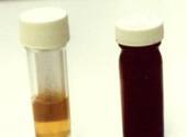 Urine colours2