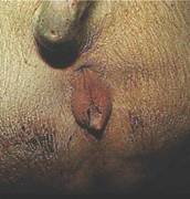 Repro oestrous discharge