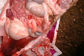 Hernia stricture 2