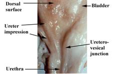 Anat Urinary UVJnormal label