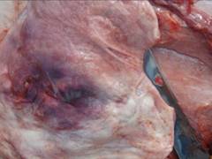 Urinary trauma clostridia uvj 12