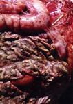 Colitis large bowel PM