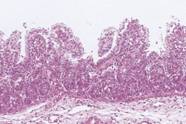 Rotovirus atrophy jejunum spb