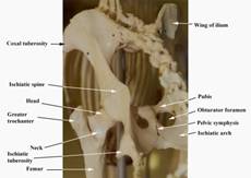 Anat%20skel%20pelvis%20rear%20label