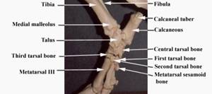 Anat%20skel%20tarsal%20medial%20label