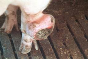 Legs chronic granuloma large 1
