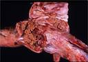 Legs infected joint adult tartus PM