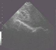 Preultra%20ovary