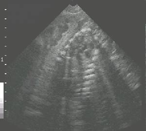 Preultraskeleton%201