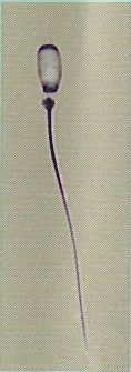 AI sperm tail proximal cytoplasmic droplet