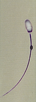 AI semen tail central cytoplasmic droplet