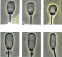 AI sperm head abnormalities 1 copy