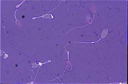 AI sperm damaged bent tails, droplet