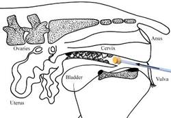 Repro-female-drawing1 catheter 1 label