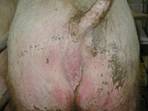 Atresia ani 04sw