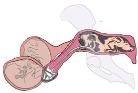 Repro foetus forwards shoulder 1