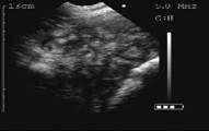17 days gestation
