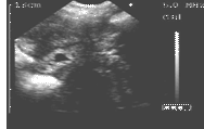 18 days gestation