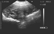 19 day gestation