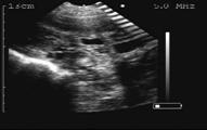 21 days gestation