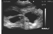 22days gestation