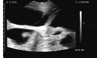 24 days gestation