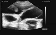 26 days gestation