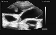 28 days gestations+