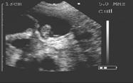 30 days gestation