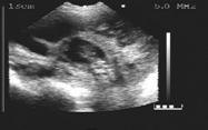45 days gestations