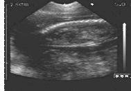 86 days gestation